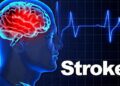সাড়ে চার ঘণ্টার মধ্যে যেতে হবে ইমার্জেন্সি স্ট্রোক সেন্টারে