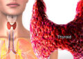 থাইরয়েড পরীক্ষা জরুরি বুঝবেন যেভাবে-