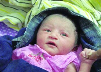 নবজাতকের জন্ডিসের জন্য রোদে দেয়া: উপকার না ক্ষতি?