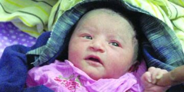 নবজাতকের জন্ডিসের জন্য রোদে দেয়া: উপকার না ক্ষতি?