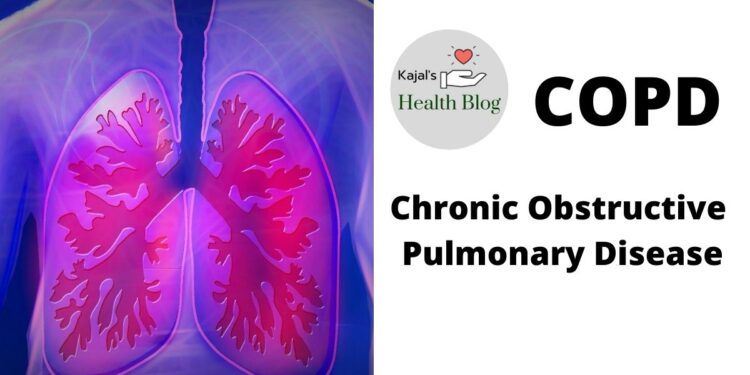 বিশ্বে মৃত্যুর তৃতীয় প্রধান কারণ হবে শ্বাসতন্ত্রের রোগ