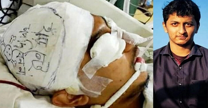 আকিবের উন্নতি সন্তোষজনক, খাবারও খেয়েছেন