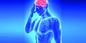 স্ট্রোকের মূল কারণ জানা গেল নতুন গবেষণায়