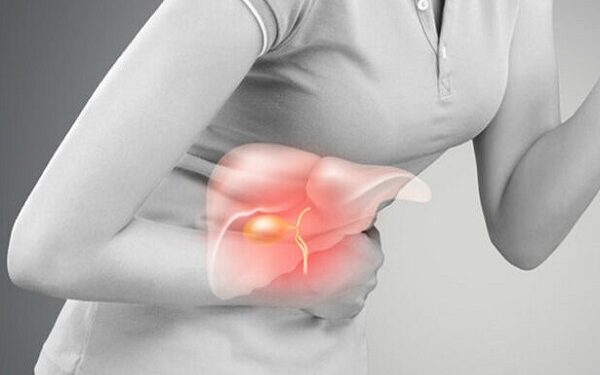 পিত্তথলিতে পাথর হলে বুঝবেন যে ৪ লক্ষণে