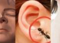 নাক বা কানে হঠাৎ কিছু ঢুকে গেলে