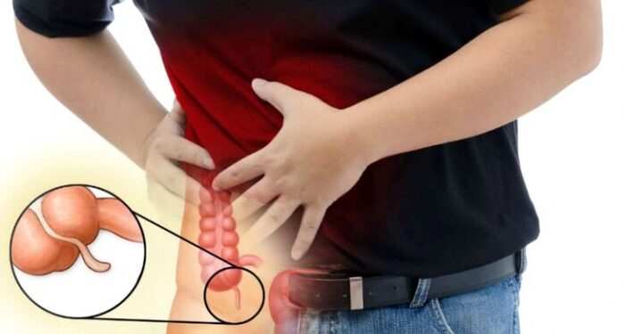 অ্যাপেন্ডিক্সের ব্যথা বুঝবেন কিভাবে ?