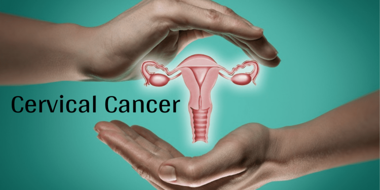 জরায়ু মুখের ক্যান্সার | কারণ, লক্ষণ, প্রতিরোধ জানেন তো?