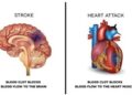 ব্রেইন স্ট্রোক না কি হার্ট অ্যাটাক যেভাবে বুঝবেন