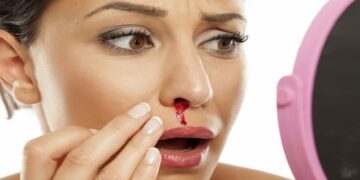 বেশি বয়সে নাক দিয়ে রক্ত পড়ার কারণ ও করণীয়