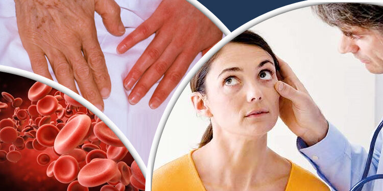 ৫ লক্ষণে বুঝবেন শরীরে রক্তশূন্যতা