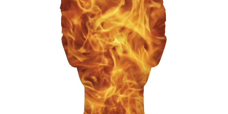 কী করবেন পুড়ে গেলে?