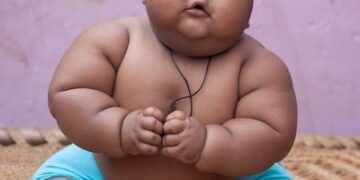 অবসাদের কারণ হতে পারে শিশুদের অতিরিক্ত মেদ