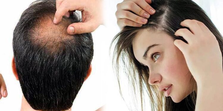 চুল পড়া কমাবে যেসব খাবার