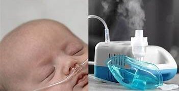 শিশুর ব্রঙ্কিওলাইটিস কেন হয়? করণীয় কী ?