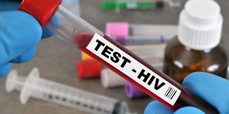 এবার চিকিৎসায় এইডসমুক্ত হলেন লিউকোমিয়ায় আক্রান্ত মার্কিন নারী