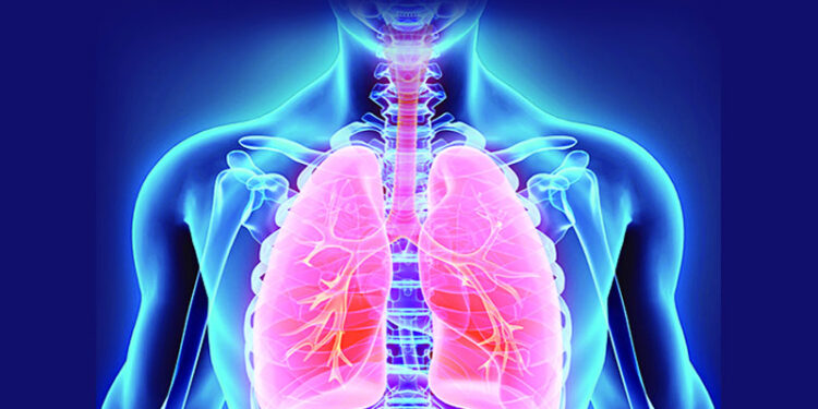 ধূমপান না করেও হতে পারে ফুসফুসের ক্যান্সার