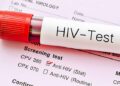 এইচআইভির নতুন রূপের সন্ধানে আশঙ্কায় বিজ্ঞানীরা