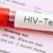 এইচআইভির নতুন রূপের সন্ধানে আশঙ্কায় বিজ্ঞানীরা