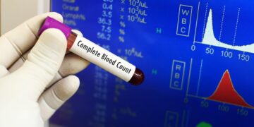 রক্তের সিবিসি পরীক্ষা কি ও কেন ?