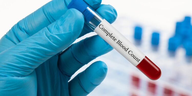 চিকিৎসা পরিভাষায় সিবিসি পরীক্ষার কথা