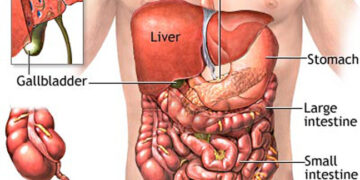পরিপাকতন্ত্রের বিরল রোগ