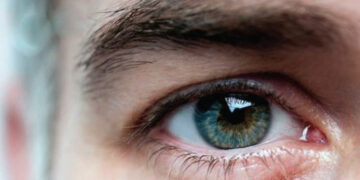 চোখের স্নায়ুকে ধ্বংস করে গ্লকোমা