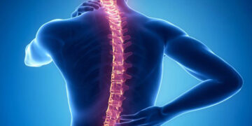 মেরুদণ্ডের টিউমার, যেভাবে বুঝবেন