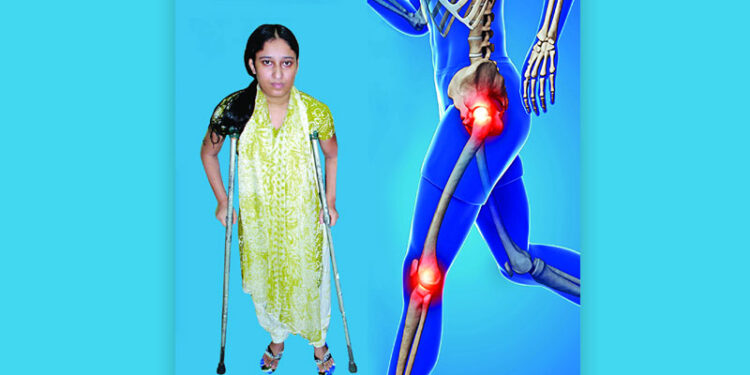 কোমর প্রতিস্থাপন কখন করাবেন, কতটা নিরাপদ?