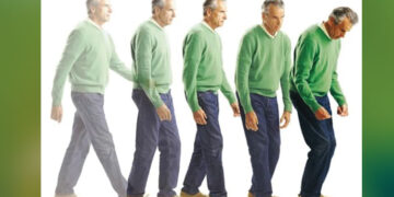 স্নায়ুরোগ পারকিনসনিজম