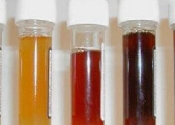 প্রশ্রাব লাল হলে কি করা উচিত?