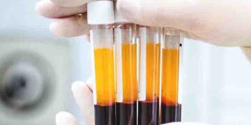 পিআরপি থেরাপি কী ?