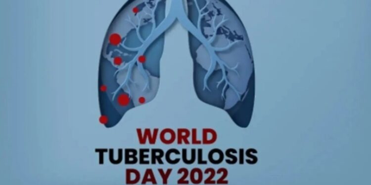 বিশ্ব যক্ষ্মা দিবস আজ