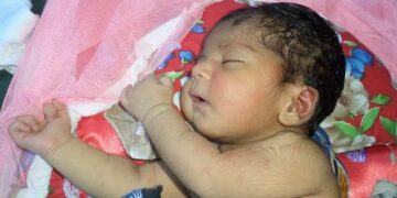 শিশুর জন্মগত ত্রুটি কেন হয়? প্রতিরোধে করণীয়