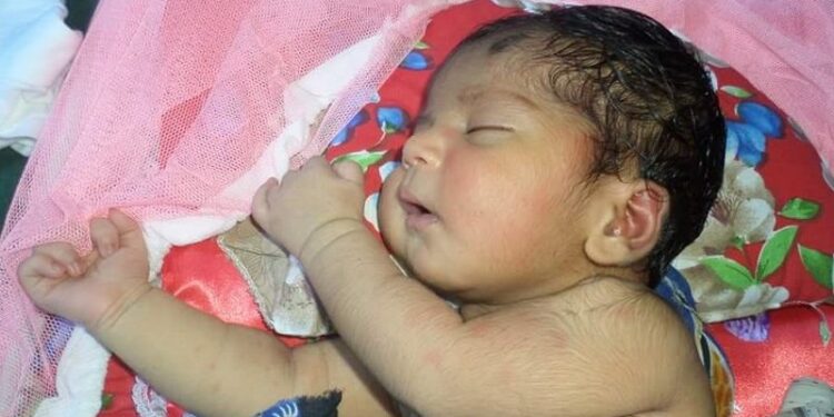 শিশুর জন্মগত ত্রুটি কেন হয়? প্রতিরোধে করণীয়