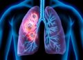 মানবদেহের ফুসফুসের ভেতরে নতুন কোষের সন্ধান