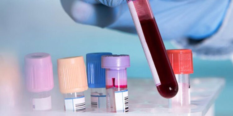 রক্ত পরীক্ষার আগে রোগী যা করবেন, যা করবেন না