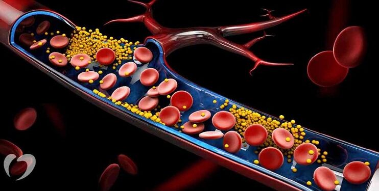 কোলেস্টেরল কমাতে কি ওষুধ খাওয়া উচিত?