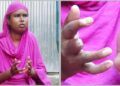 বিরল রোগ ‘সিস্টেমিক স্কেলেরোসিসে’ আক্রান্ত শরিফা, ছড়িয়ে পড়ছে সব আঙুলে