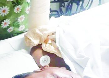 সাড়ে ৯ ঘণ্টা অস্ত্রোপচারে কবজি প্রতিস্থাপন !