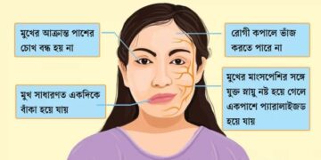 হঠাৎ মুখ বেঁকে গেলে