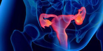 জরায়ুতে সমস্যা, কীভাবে বুঝবেন?