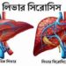 লিভার সিরোসিসে ‘শান্ট অপারেশনে’ সাফল্য পেলেন বাংলাদেশের সার্জন