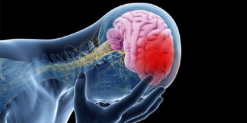 ব্রেন এজিংয়ের কারণ ও লক্ষণ