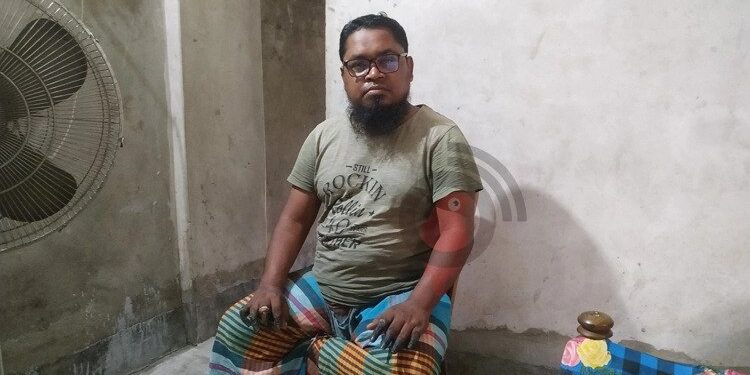 আঙুলের পর এবার ‘পাথর’ হয়ে যাচ্ছে নুরুল আমিনের চোখ
