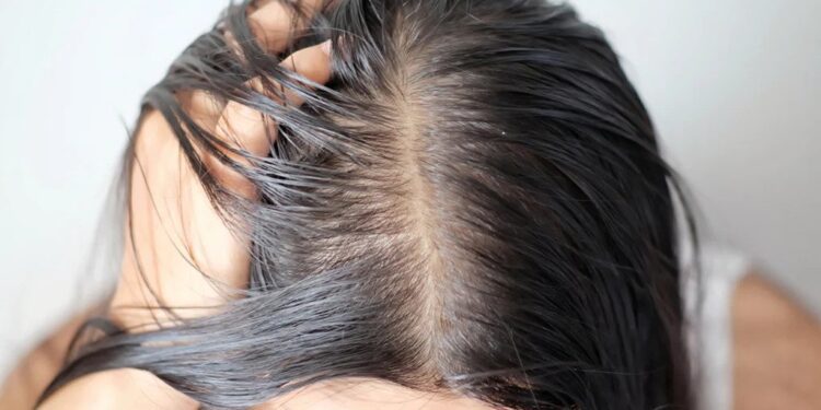 চুল পাতলা হয়ে গেলে করণীয়-