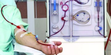 সহজ পদ্ধতিতে ডায়ালাইসিস ‘সিএপিডি’