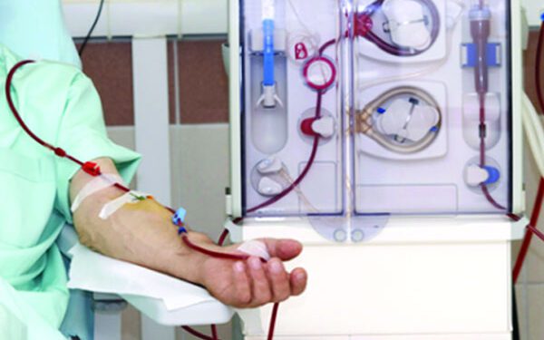 সহজ পদ্ধতিতে ডায়ালাইসিস ‘সিএপিডি’