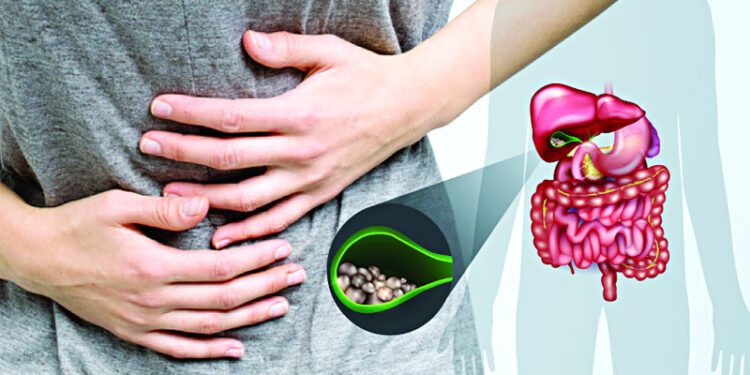 পিত্তথলিতে পাথর জমার লক্ষণ বুঝবেন যেভাবে