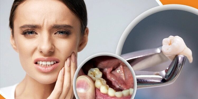 আক্কেল দাঁতের ব্যথা