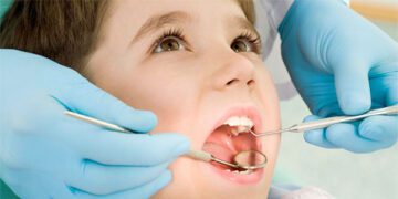 শিশুর দাঁতের ক্ষয়